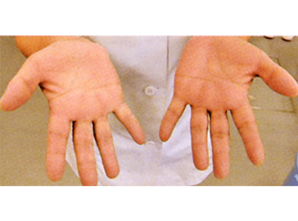手指の検査